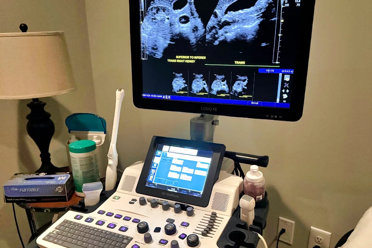 An ultrasound machine (representative)
